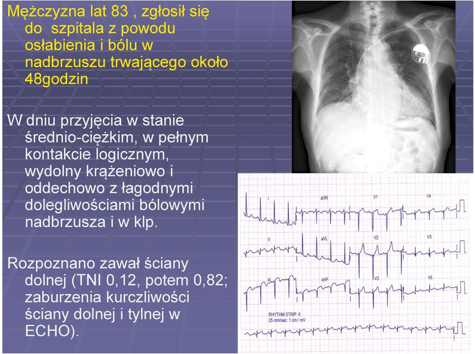 wydolny krążeniowo i oddechowo z łagodnymi dolegliwościami bólowymi nadbrzusza i w klp.