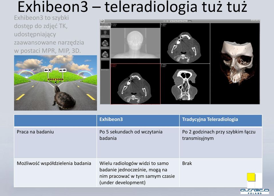 Praca na badaniu Exhibeon3 Po 5 sekundach od wczytania badania Tradycyjna Teleradiologia Po 2 godzinach