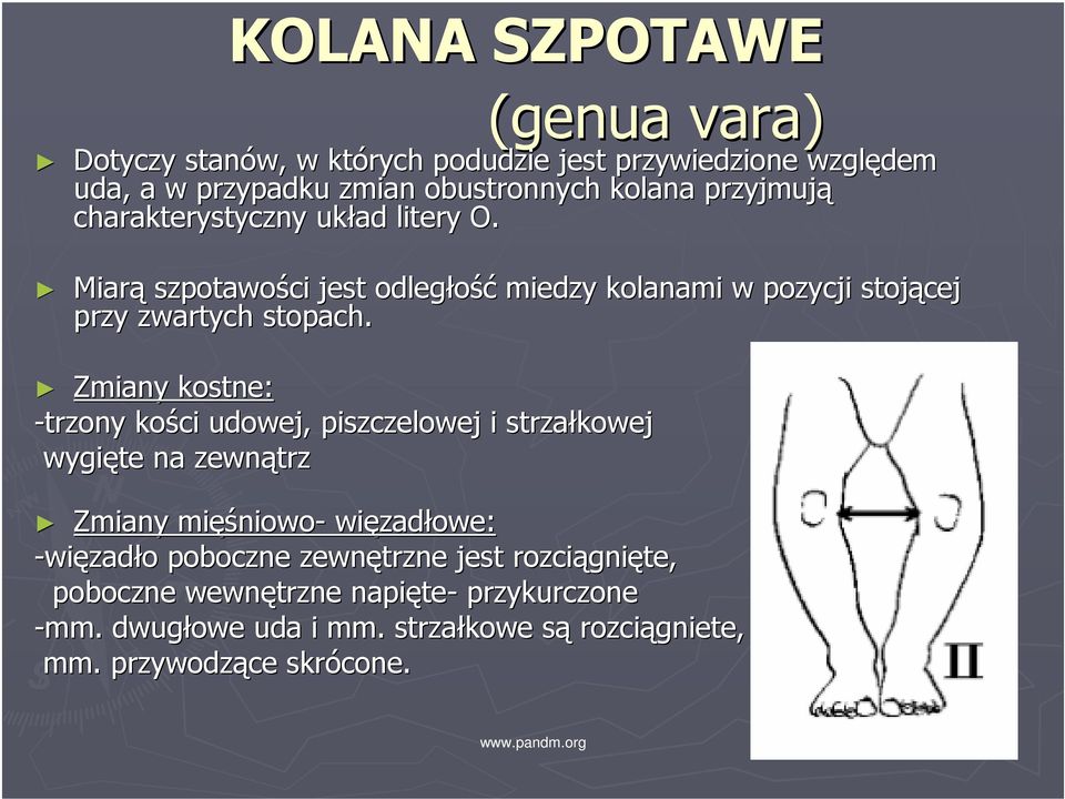 Zmiany kostne: -trzony kości udowej, piszczelowej i strzałkowej wygięte na zewnątrz Zmiany mięś ęśniowo- więzad zadłowe: -więzadło o poboczne