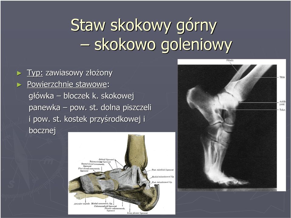 główka bloczek k. skokowej panewka pow. st.