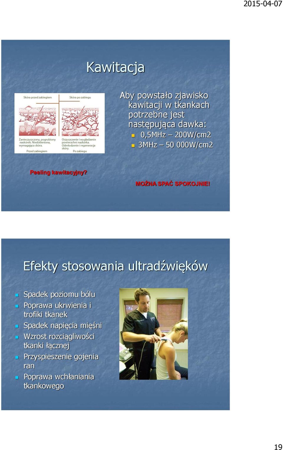 Efekty stosowania ultradźwięków Spadek poziomu bólu Poprawa ukrwienia i trofiki tkanek