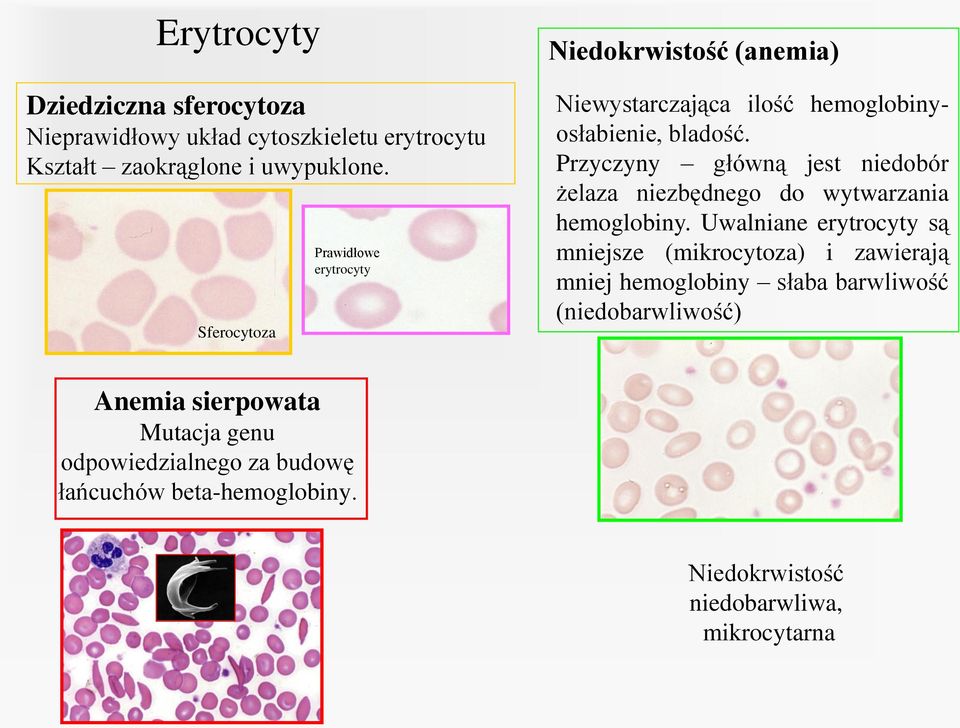 Przyczyny główną jest niedobór żelaza niezbędnego do wytwarzania hemoglobiny.