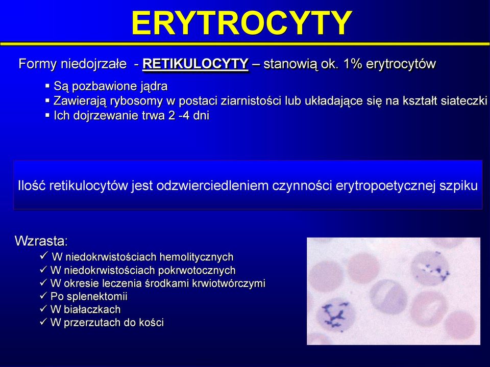 siateczki Ich dojrzewanie trwa 2-4 dni Ilość retikulocytów jest odzwierciedleniem czynności erytropoetycznej