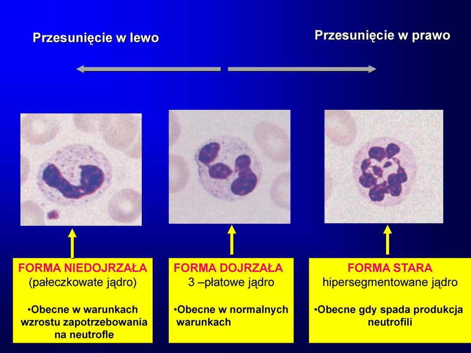 neutrofle FORMA DOJRZAŁA 3 płatowe jądro Obecne w normalnych