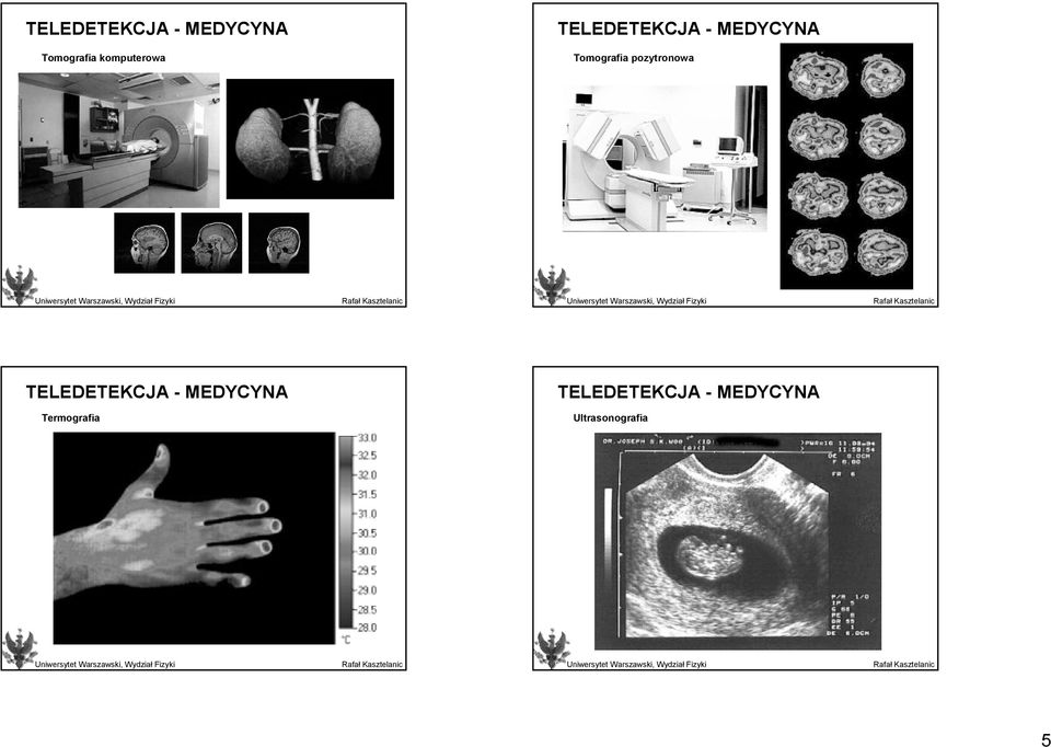 pozytronowa  MEDYCYNA Termografia