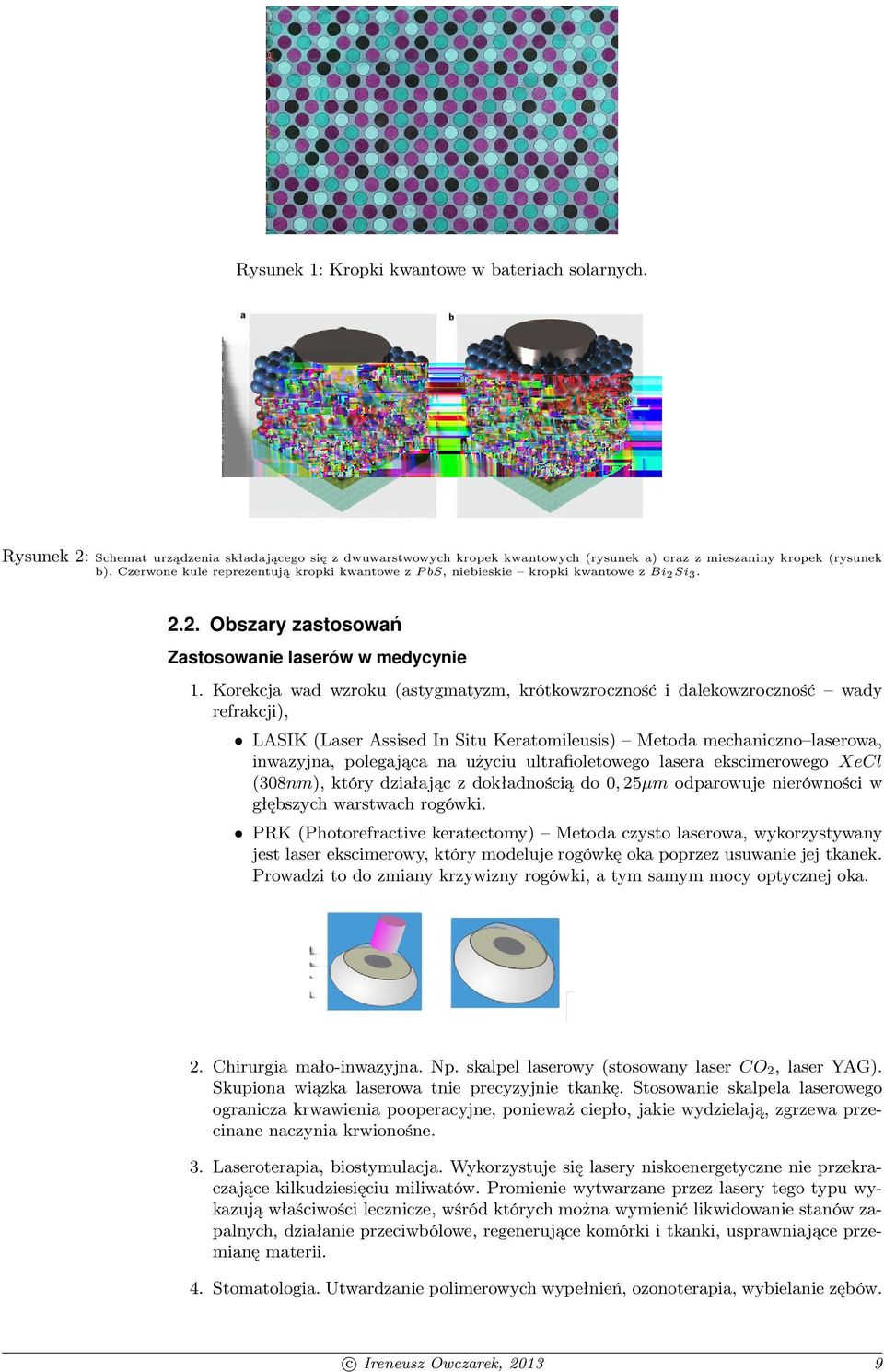 Korekcja wad wzroku (astygmatyzm, krótkowzroczność i dalekowzroczność wady refrakcji), LASIK (Laser Assised In Situ Keratomileusis) Metoda mechaniczno laserowa, inwazyjna, polegająca na użyciu