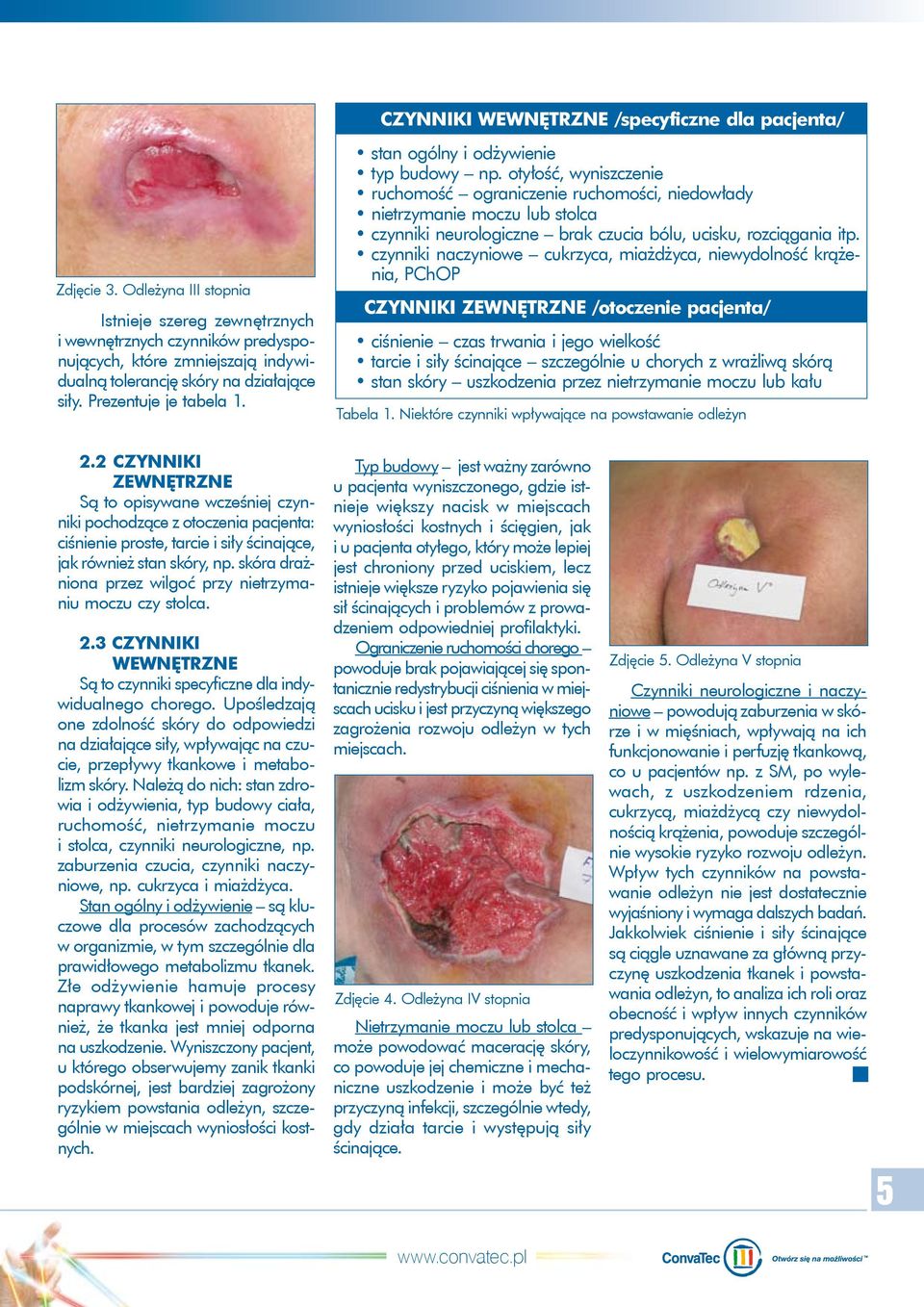 otyłość, wyniszczenie ruchomość ograniczenie ruchomości, niedowłady nietrzymanie moczu lub stolca czynniki neurologiczne brak czucia bólu, ucisku, rozciągania itp.