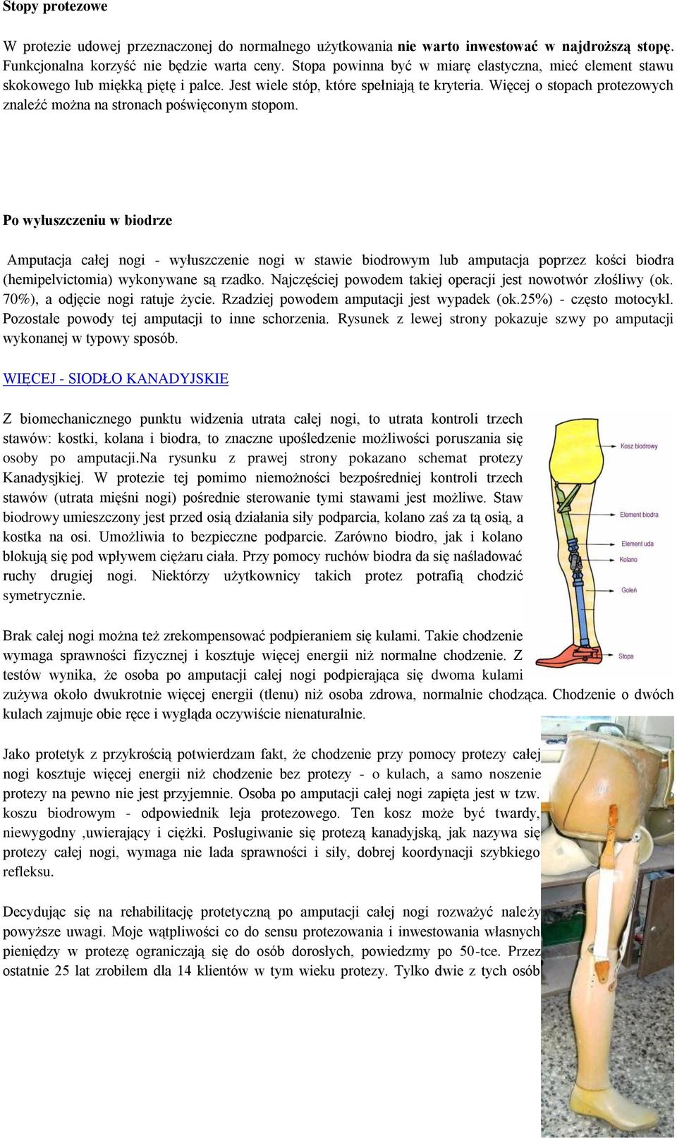 Więcej o stopach protezowych znaleźć można na stronach poświęconym stopom.