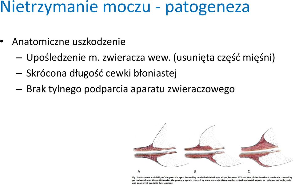 (usunięta część mięśni) Skrócona długość cewki