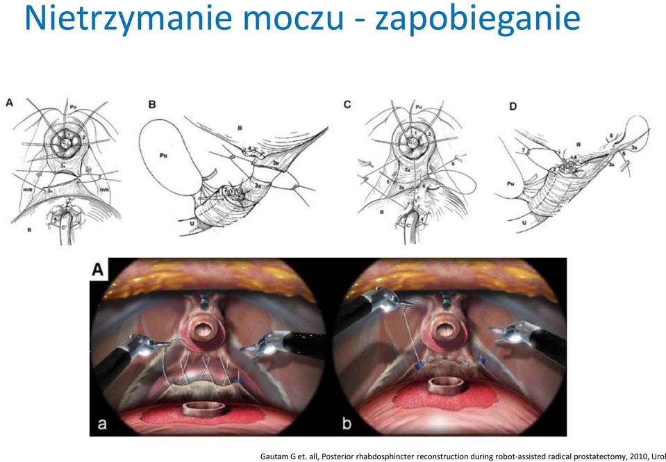 all, Posterior rhabdosphincter