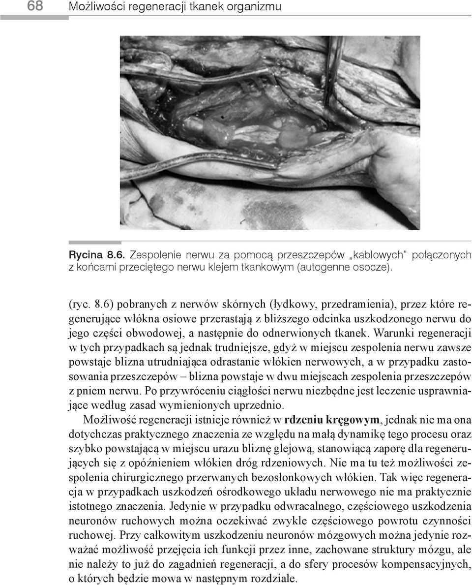 6) pobranych z nerwów skórnych (łydkowy, przedramienia), przez które regenerujące włókna osiowe przerastają z bliższego odcinka uszkodzonego nerwu do jego części obwodowej, a następnie do