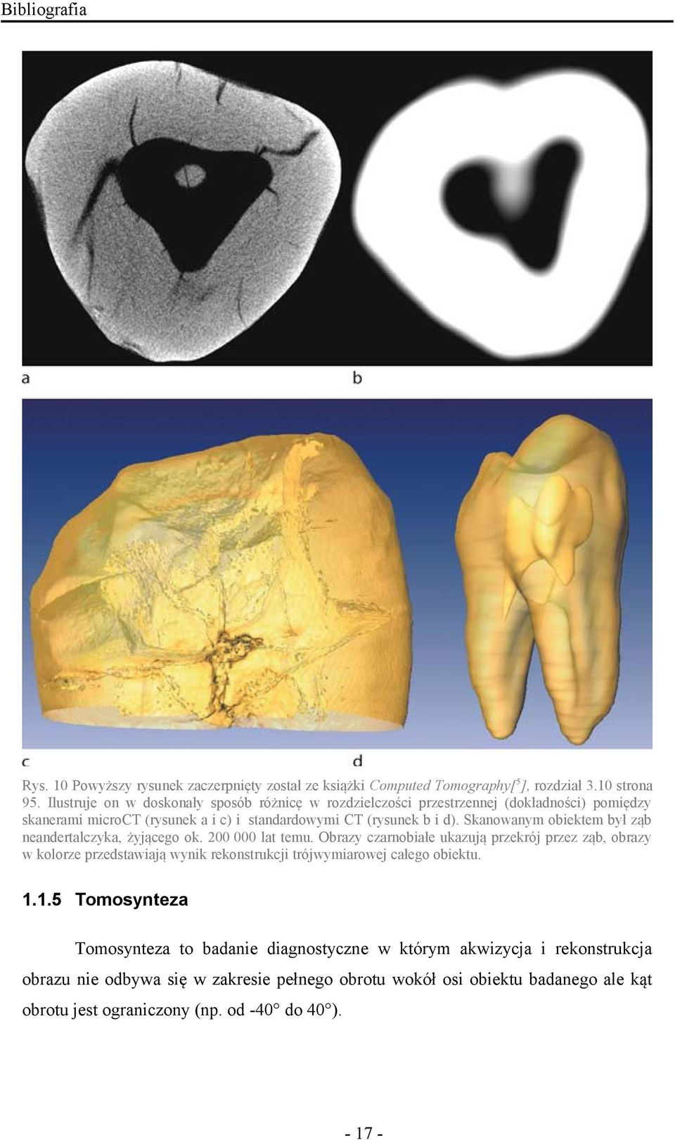 Skanowanym obiektem był ząb neandertalczyka, żyjącego ok. 200 000 lat temu.