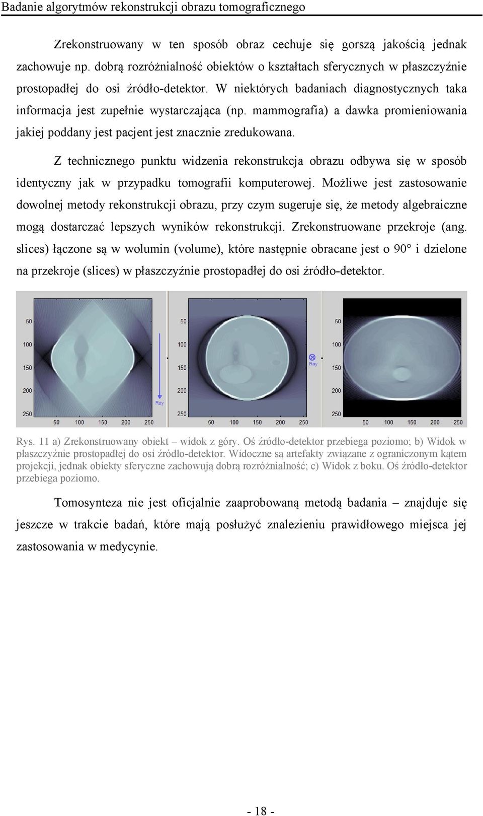 mammografia) a dawka promieniowania jakiej poddany jest pacjent jest znacznie zredukowana.