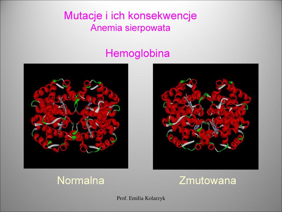 Anemia sierpowata