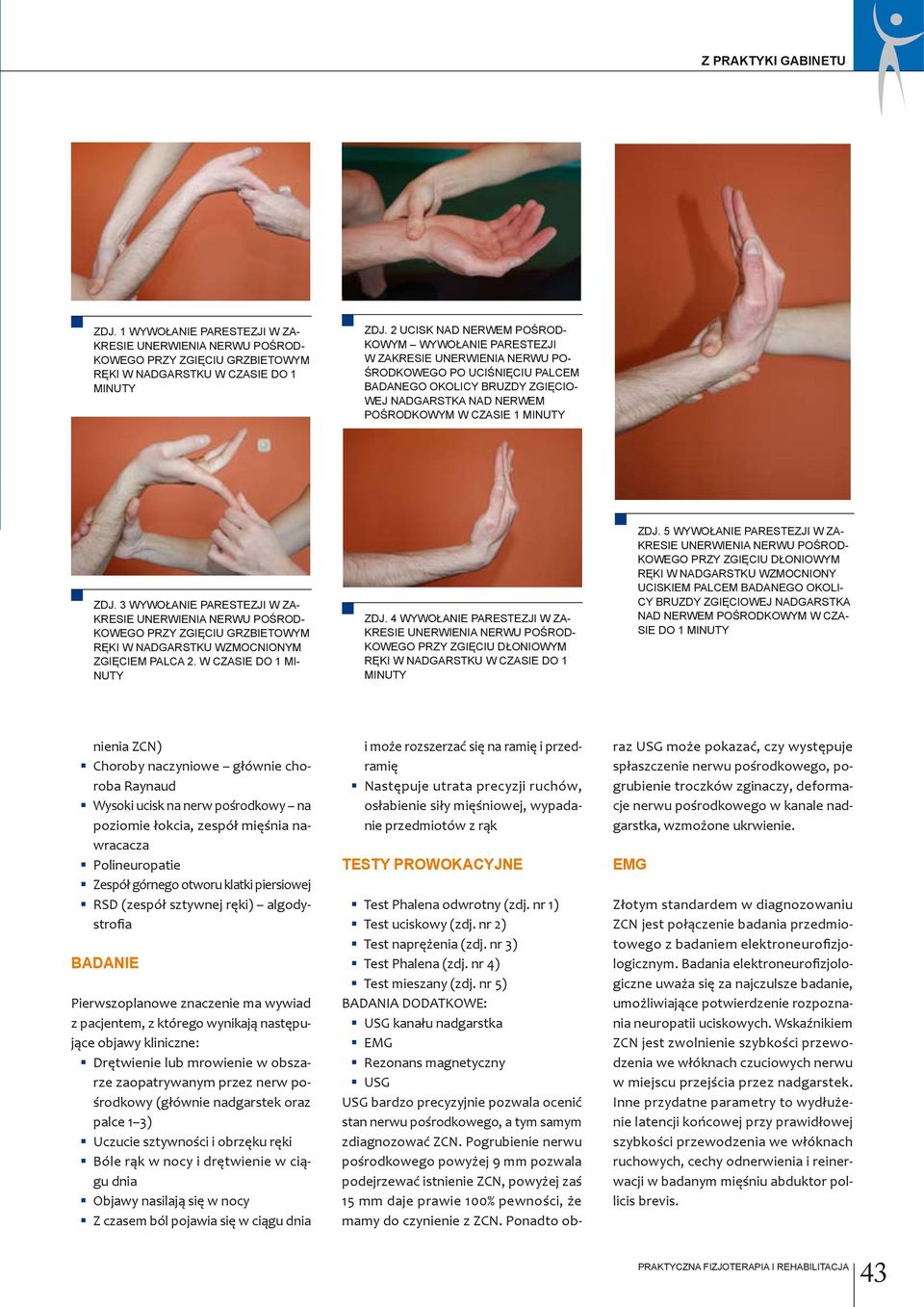 minuty zdj. 3 wywołanie parestezji w zakresie unerwienia nerwu pośrodkowego przy zgięciu grzbietowym ręki w nadgarstku wzmocnionym zgięciem palca 2. w czasie do 1 minuty zdj.