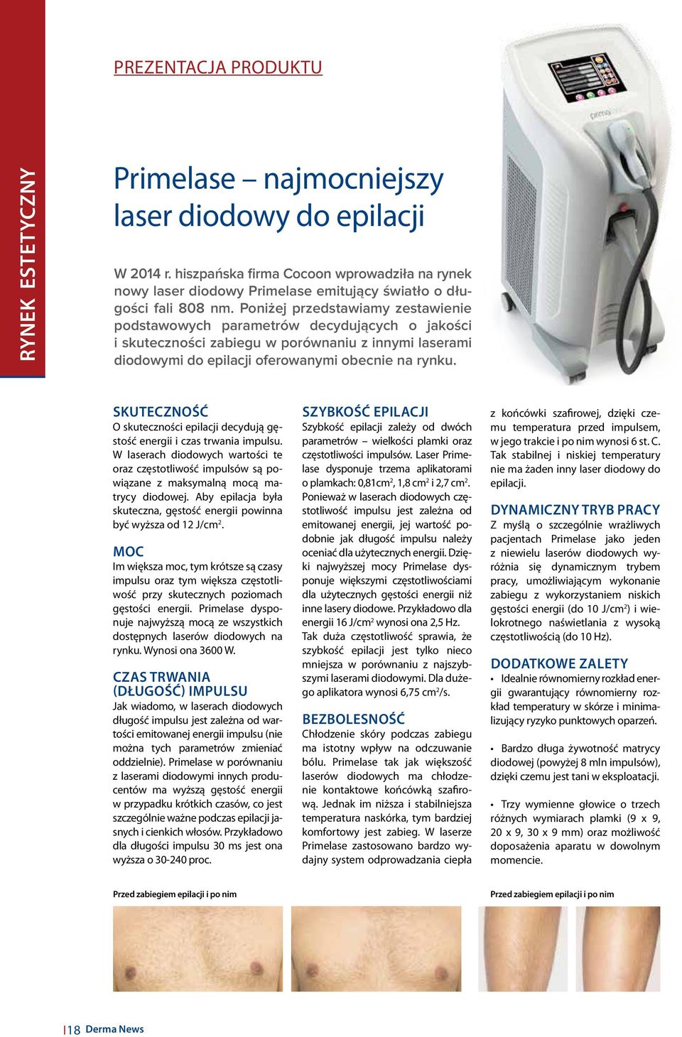 Poniżej przedstawiamy zestawienie podstawowych parametrów decydujących o jakości i skuteczności zabiegu w porównaniu z innymi laserami diodowymi do epilacji oferowanymi obecnie na rynku.
