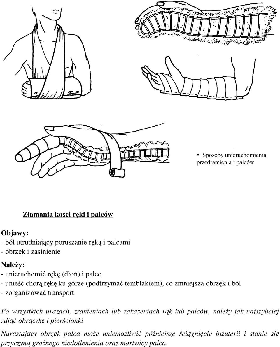zorganizować transport Po wszystkich urazach, zranieniach lub zakażeniach rąk lub palców, należy jak najszybciej zdjąć obrączkę i