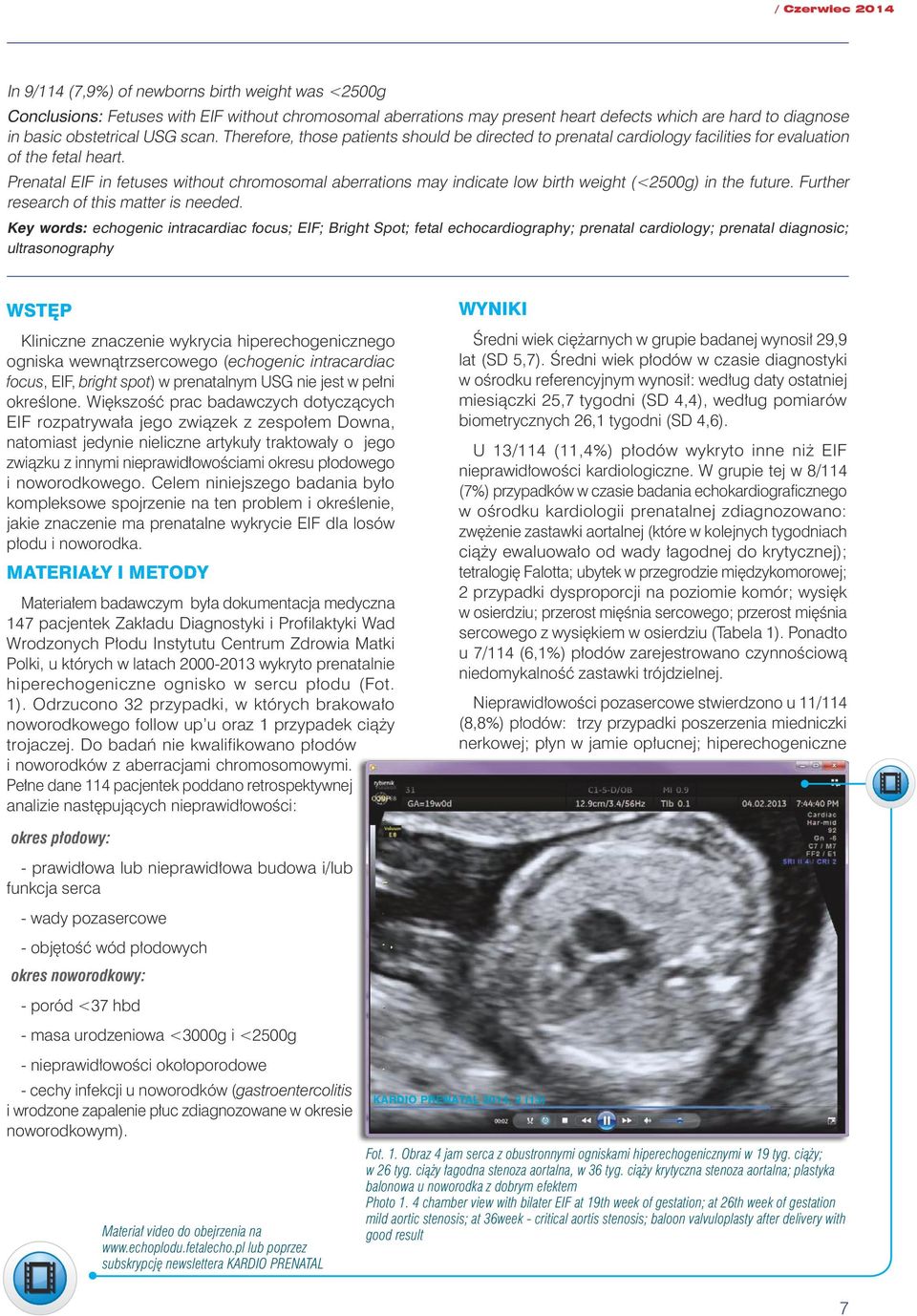 Prenatal EIF in fetuses without chromosomal aberrations may indicate low birth weight (<2500g) in the future. Further research of this matter is needed.