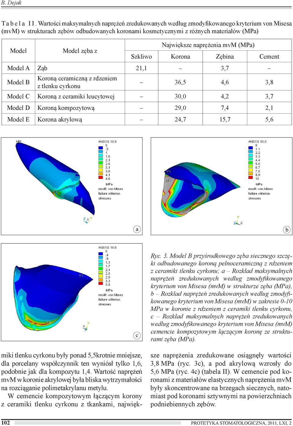 Największe naprężenia mvm (MPa) Szkliwo Korona Zębina Cement Model A Ząb 21,1 3,7 Model B Koroną ceramiczną z rdzeniem z tlenku cyrkonu 36,5 4,6 3,8 Model C Koroną z ceramiki leucytowej 30,0 4,2 3,7