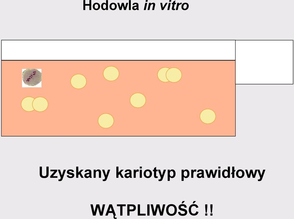 kariotyp