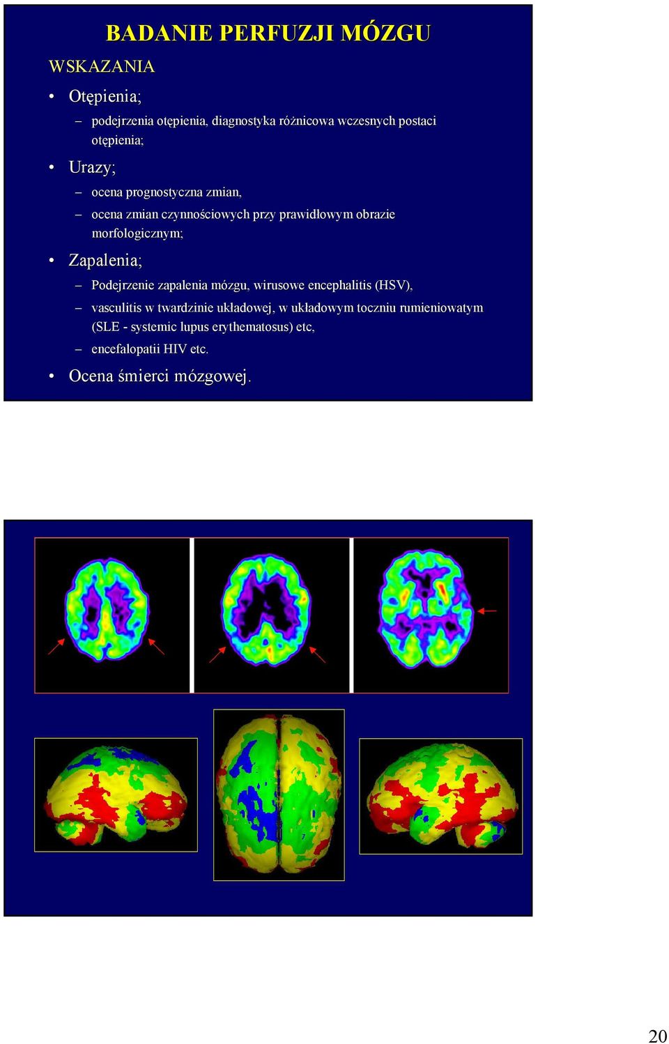 Zapalenia; Podejrzenie zapalenia mózgu, wirusowe encephalitis (HSV), vasculitis w twardzinie układowej, w