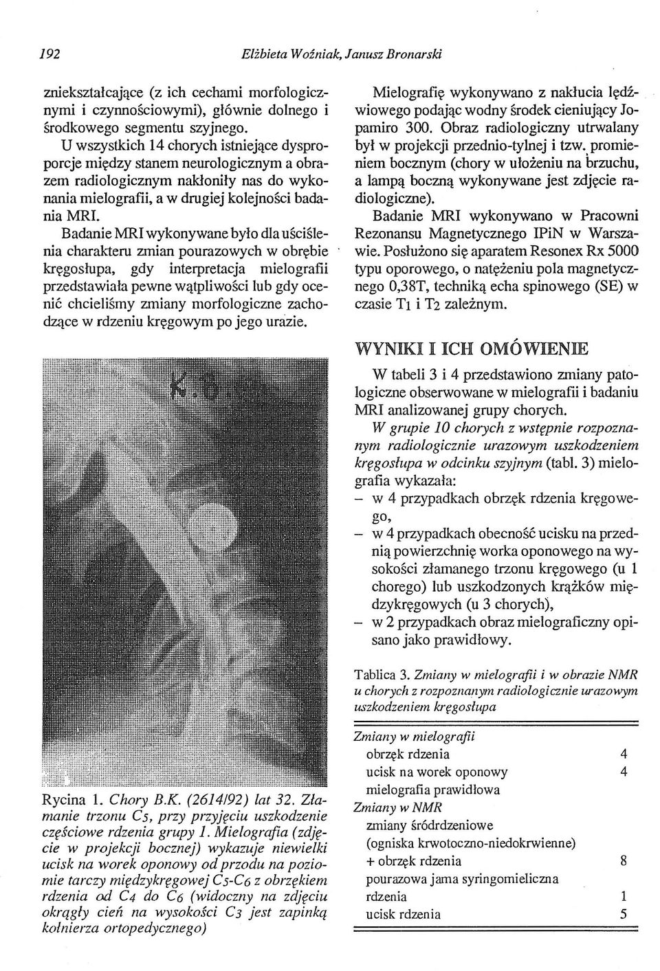 Badanie MRI wykonywane było dla uściślenia charakteru zmian pourazowych w obrębie kręgosłupa, gdy interpretacja mielografii przedstawiała pewne wątpliwości lub gdy ocenić chcieliśmy zmiany