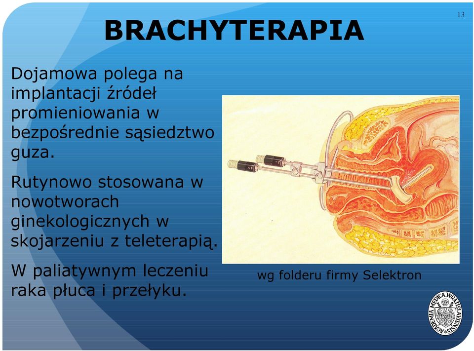 Rutynowo stosowana w nowotworach ginekologicznych w skojarzeniu