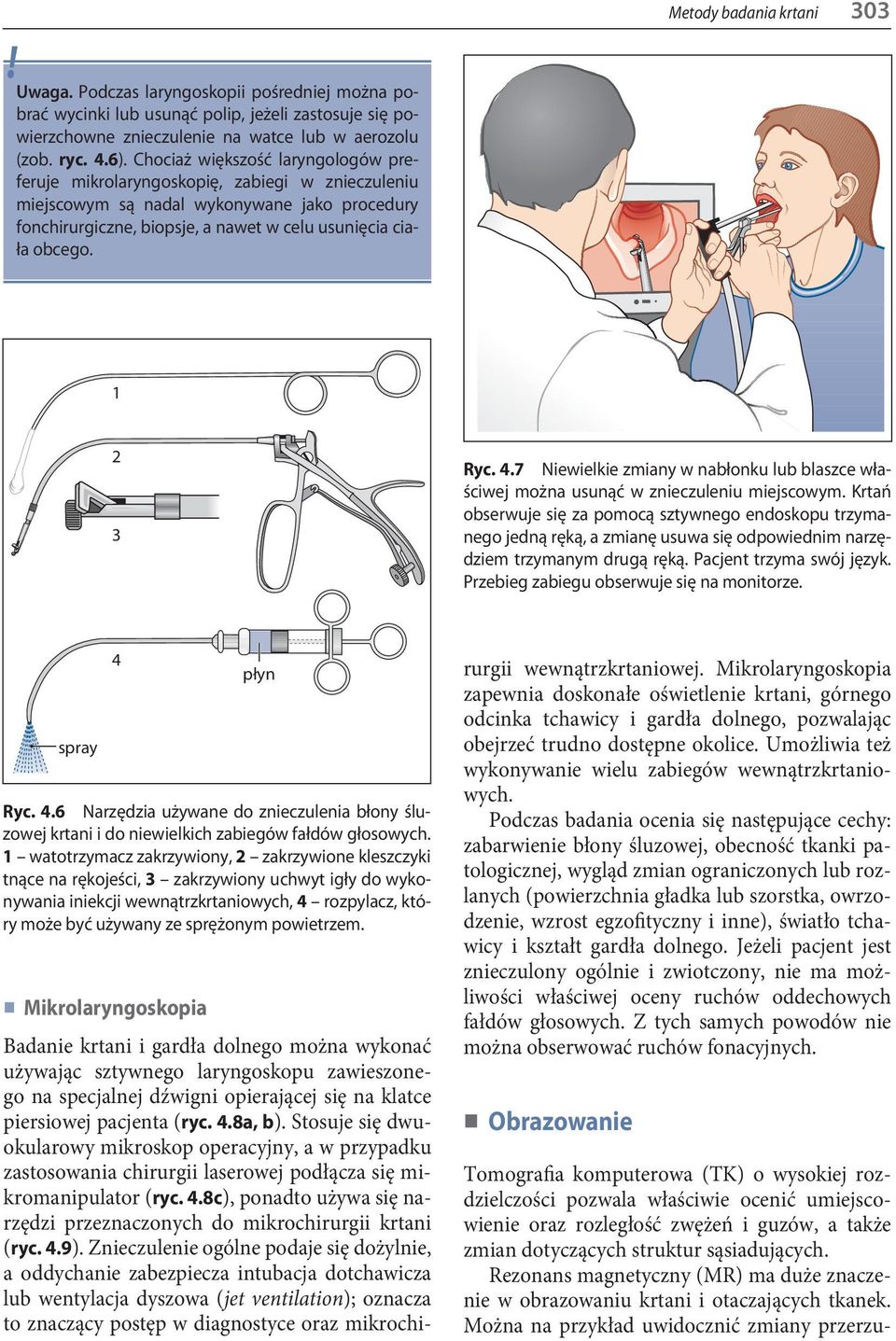 Metody badania krtani 303 1 2 3 Ryc. 4.7 Niewielkie zmiany w nabłonku lub blaszce właściwej można usunąć w znieczuleniu miejscowym.