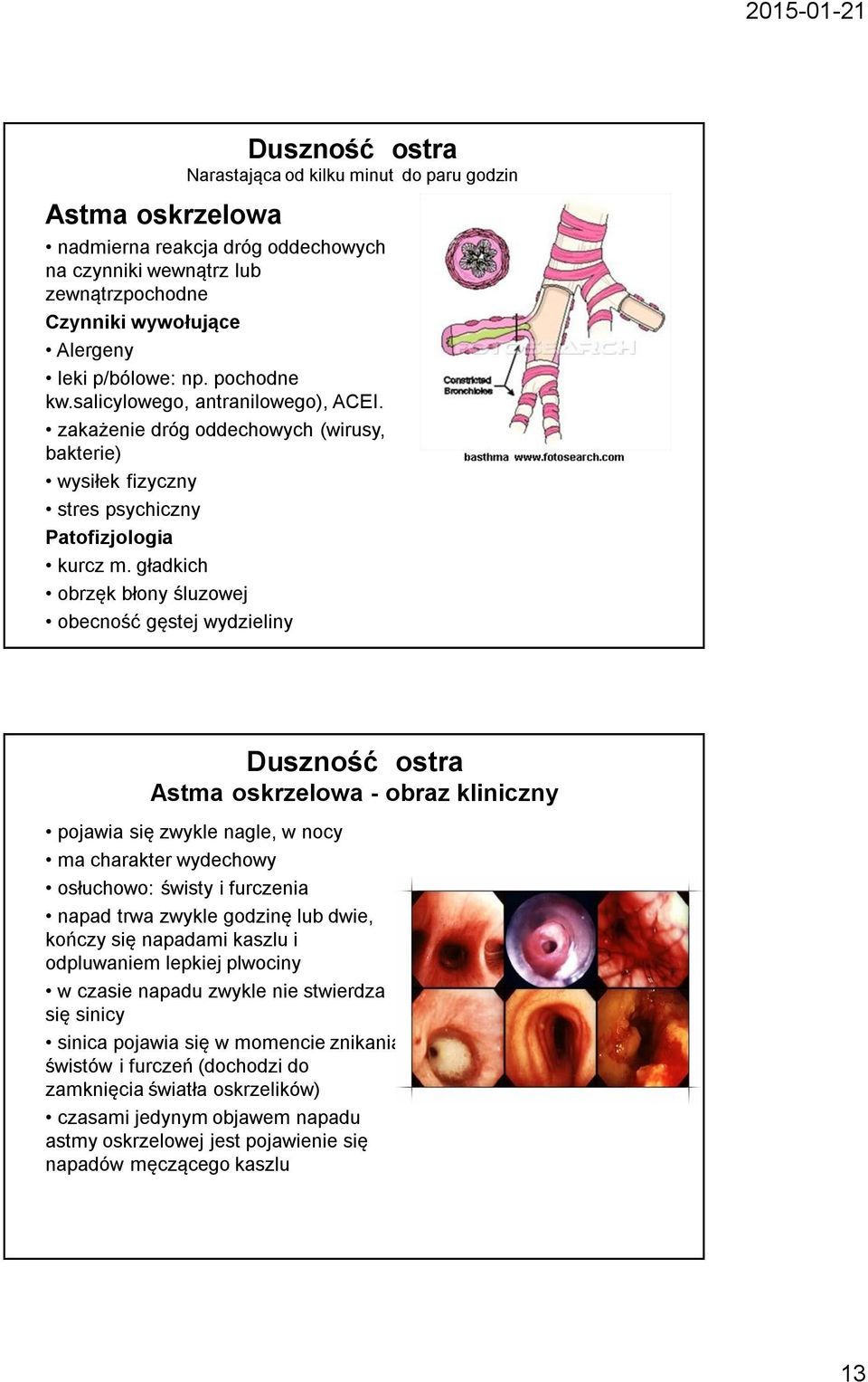 gładkich obrzęk błony śluzowej obecność gęstej wydzieliny Duszność ostra Astma oskrzelowa - obraz kliniczny pojawia się zwykle nagle, w nocy ma charakter wydechowy osłuchowo: świsty i furczenia napad