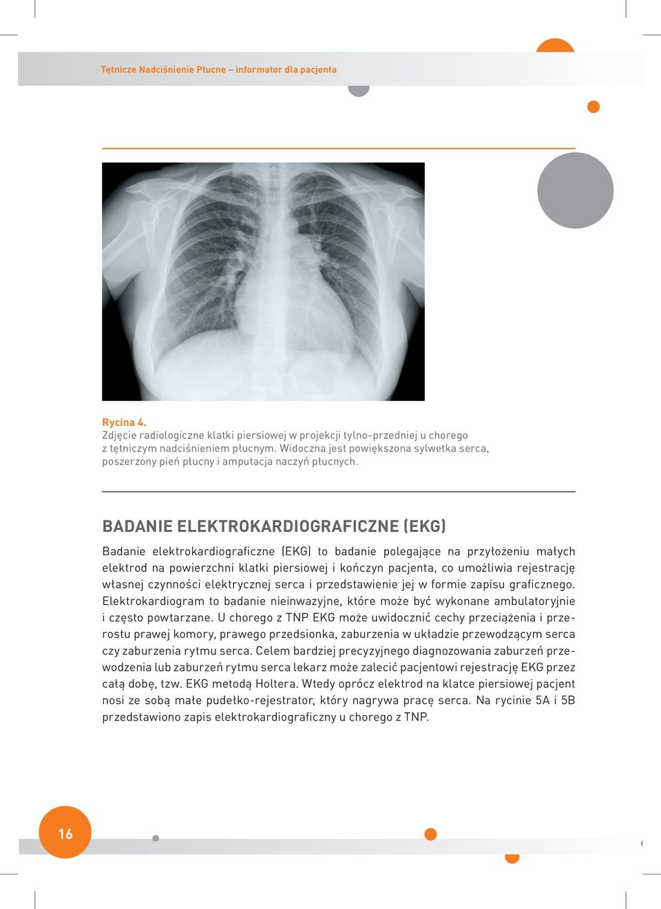 Badanie elektrokardiograficzne (EKG) Badanie elektrokardiograficzne (EKG) to badanie polegające na przyłożeniu małych elektrod na powierzchni klatki piersiowej i kończyn pacjenta, co umożliwia