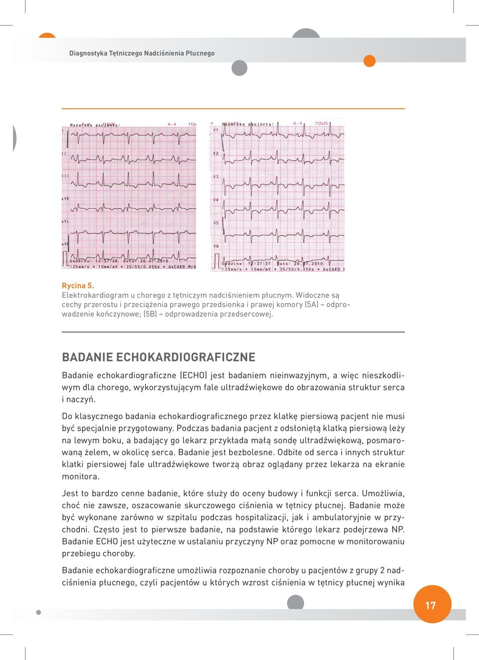 Badanie echokardiograficzne Badanie echokardiograficzne (ECHO) jest badaniem nieinwazyjnym, a więc nieszkodliwym dla chorego, wykorzystującym fale ultradźwiękowe do obrazowania struktur serca i