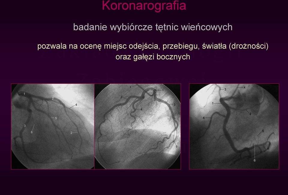 ocenę miejsc odejścia, przebiegu,