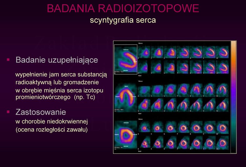 lub gromadzenie w obrębie mięśnia serca izotopu