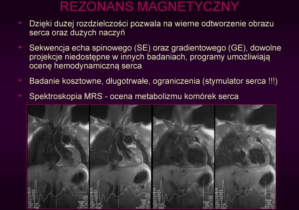 niedostępne w innych badaniach, programy umożliwiają ocenę hemodynamiczną serca Badanie