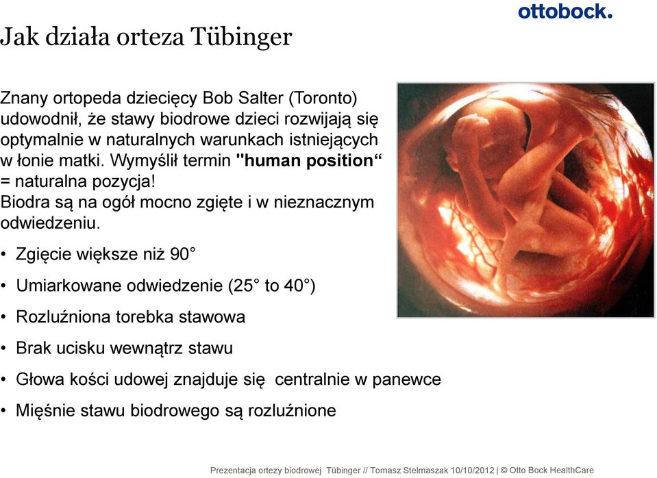 Biodra są na ogół mocno zgięte i w nieznacznym odwiedzeniu.