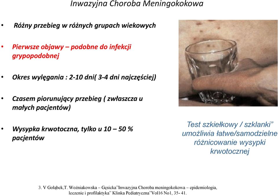 tylko u 10 50 % pacjentów Test szkiełkowy / szklanki umożliwia łatwe/samodzielne różnicowanie wysypki krwotocznej 3. V Gołąbek,T.