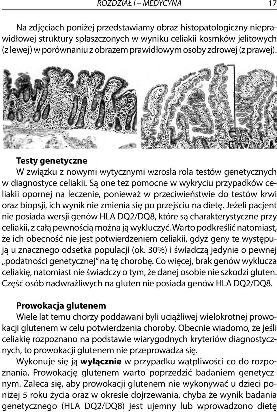 Są one też pomocne w wykryciu przypadków celiakii opornej na leczenie, ponieważ w przeciwieństwie do testów krwi oraz biopsji, ich wynik nie zmienia się po przejściu na dietę.