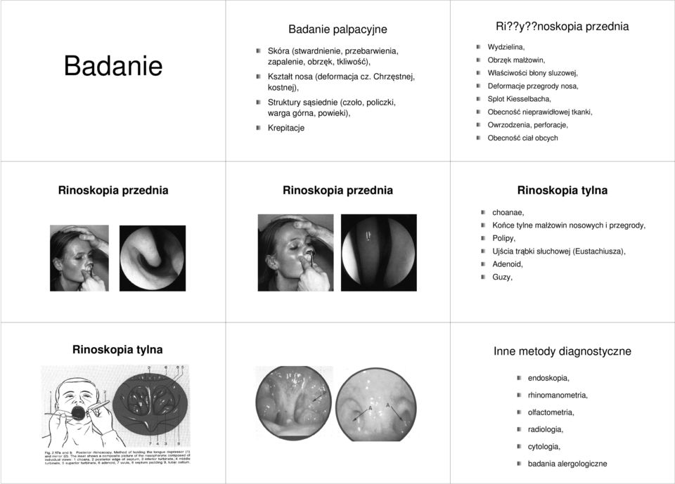 małżowin, Deformacje przegrody nosa, Obecność nieprawidłowej tkanki, Obecność ciał obcych Rinoskopia przednia Rinoskopia przednia Rinoskopia tylna choanae, Końce tylne małżowin