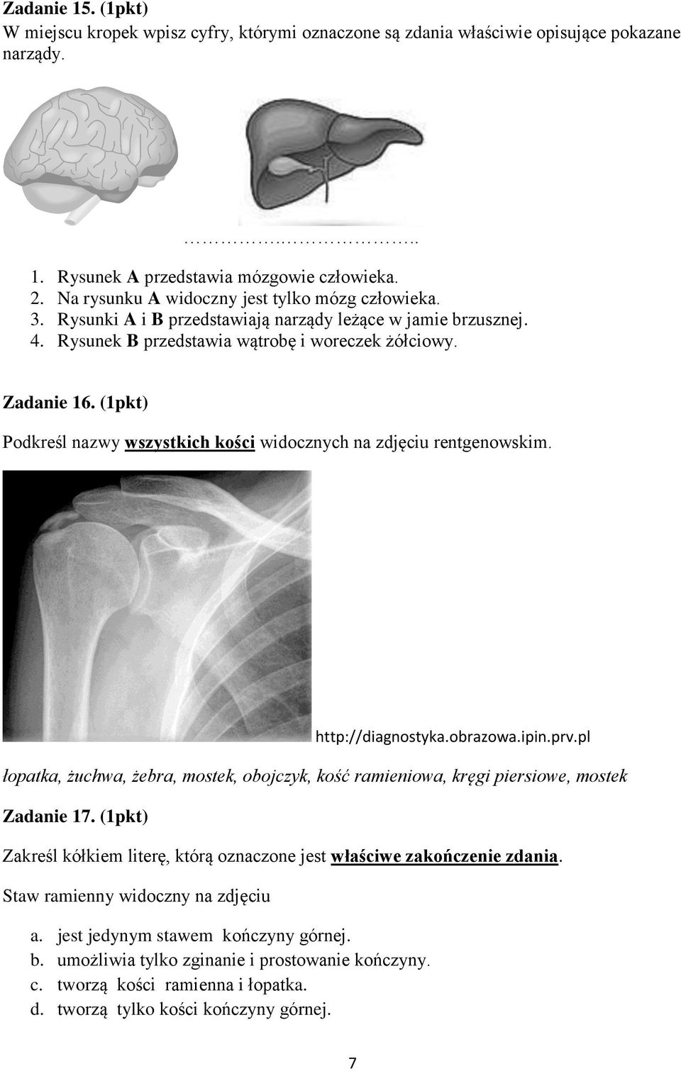(1pkt) Podkreśl nazwy wszystkich kości widocznych na zdjęciu rentgenowskim. http://diagnostyka.obrazowa.ipin.prv.