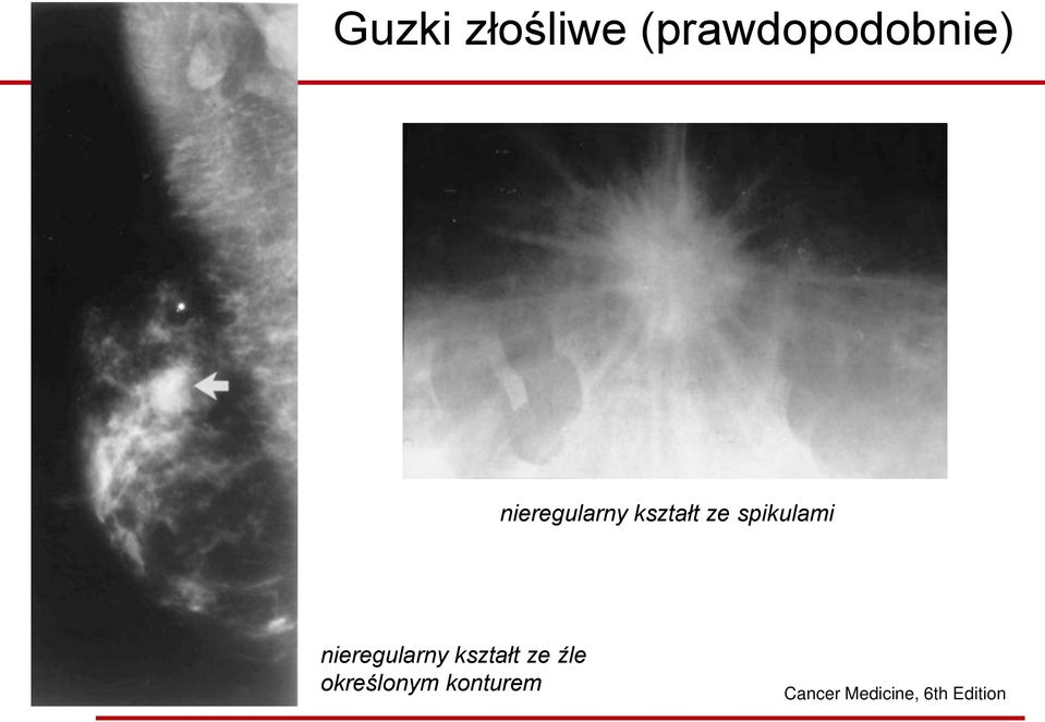 nieregularny kształt ze źle