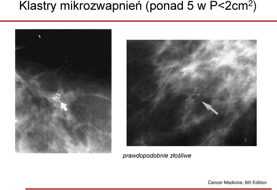 prawdopodobnie złośliwe