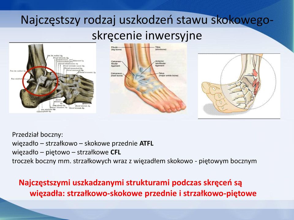 boczny mm.