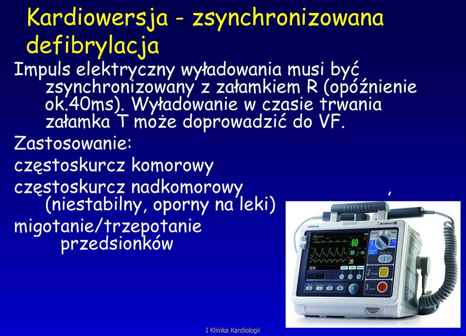 Wyładowanie w czasie trwania załamka T może doprowadzić do VF.