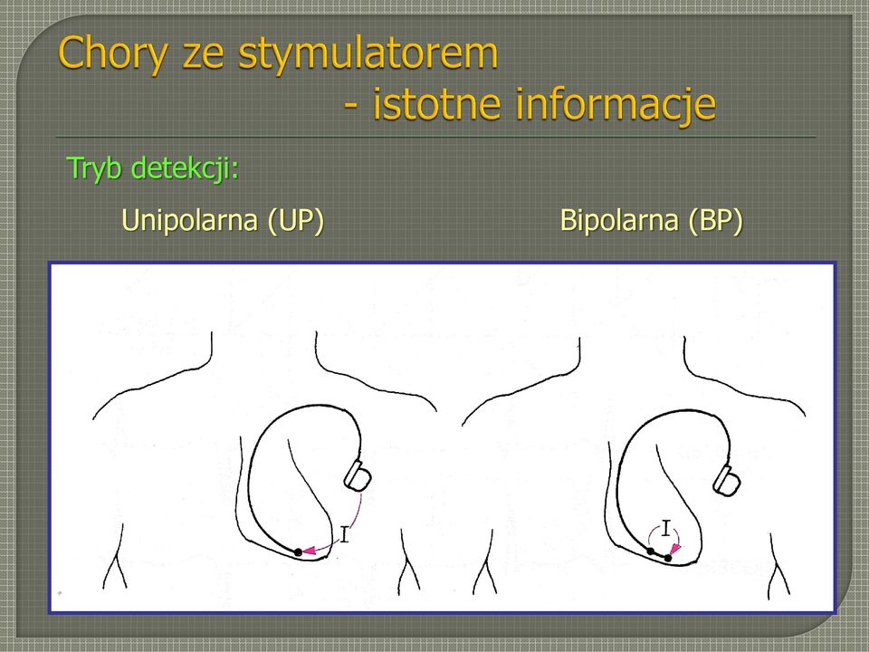 Unipolarna