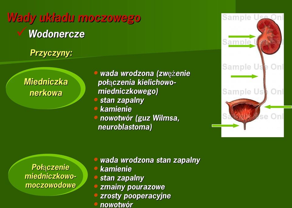 kielichowomiedniczkowego) stan zapalny kamienie nowotwór (guz Wilmsa,