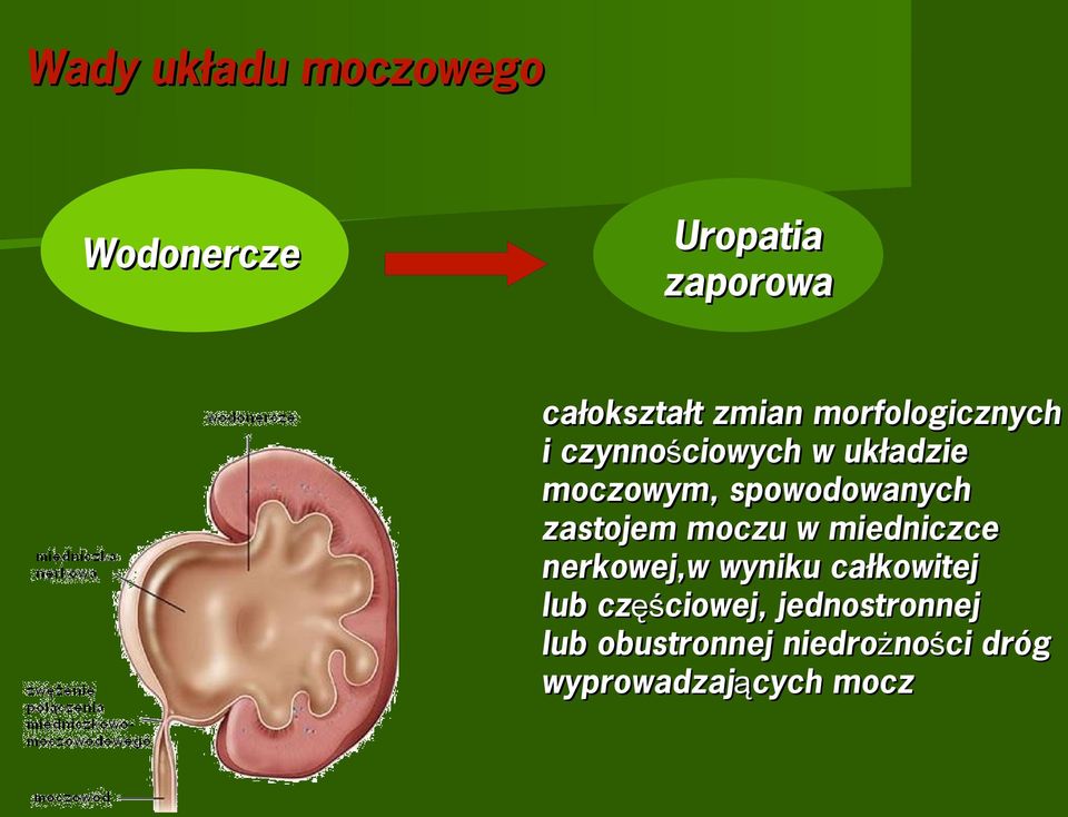 zastojem moczu w miedniczce nerkowej,w wyniku całkowitej lub