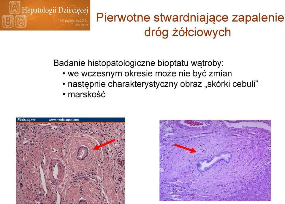 wątroby: we wczesnym okresie może nie być zmian