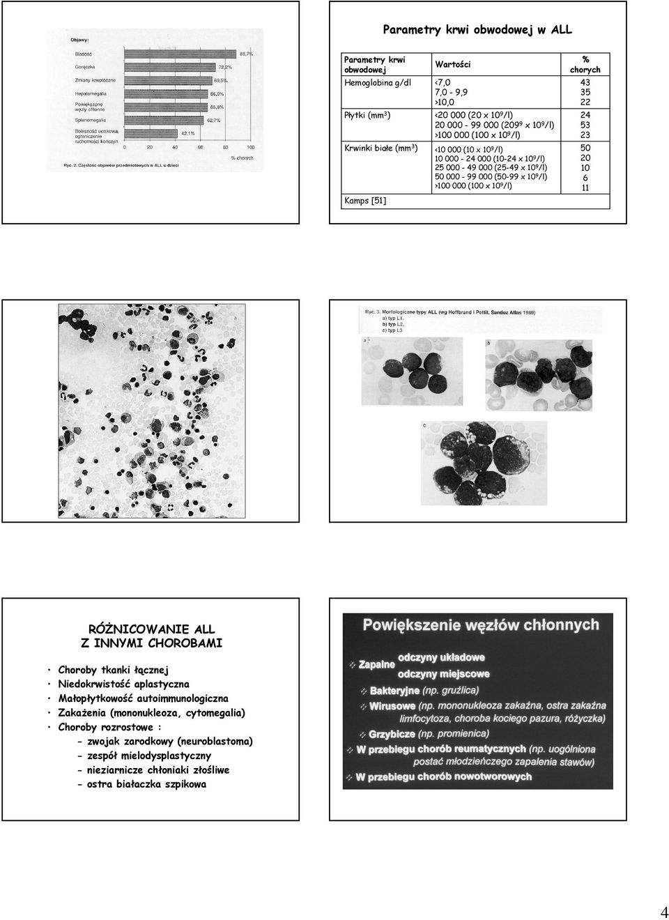 >100 000 (100 x 109/l) 50 20 10 6 11 Kamps [51] RÓśNICOWANIE ALL Z INNYMI CHOROBAMI Choroby tkanki łącznej Niedokrwistość aplastyczna Małopłytkowość autoimmunologiczna