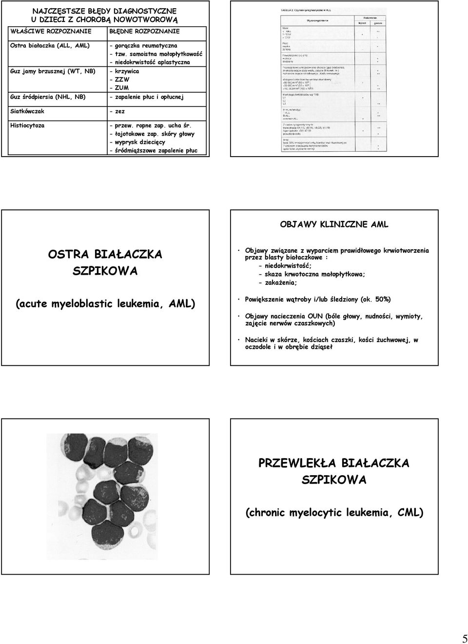 skóry głowy - wyprysk dziecięcy - śródmiąŝszowe zapalenie płuc OBJAWY KLINICZNE AML OSTRA BIAŁACZKA SZPIKOWA (acute myeloblastic leukemia, AML) Objawy związane z wyparciem prawidłowego krwiotworzenia