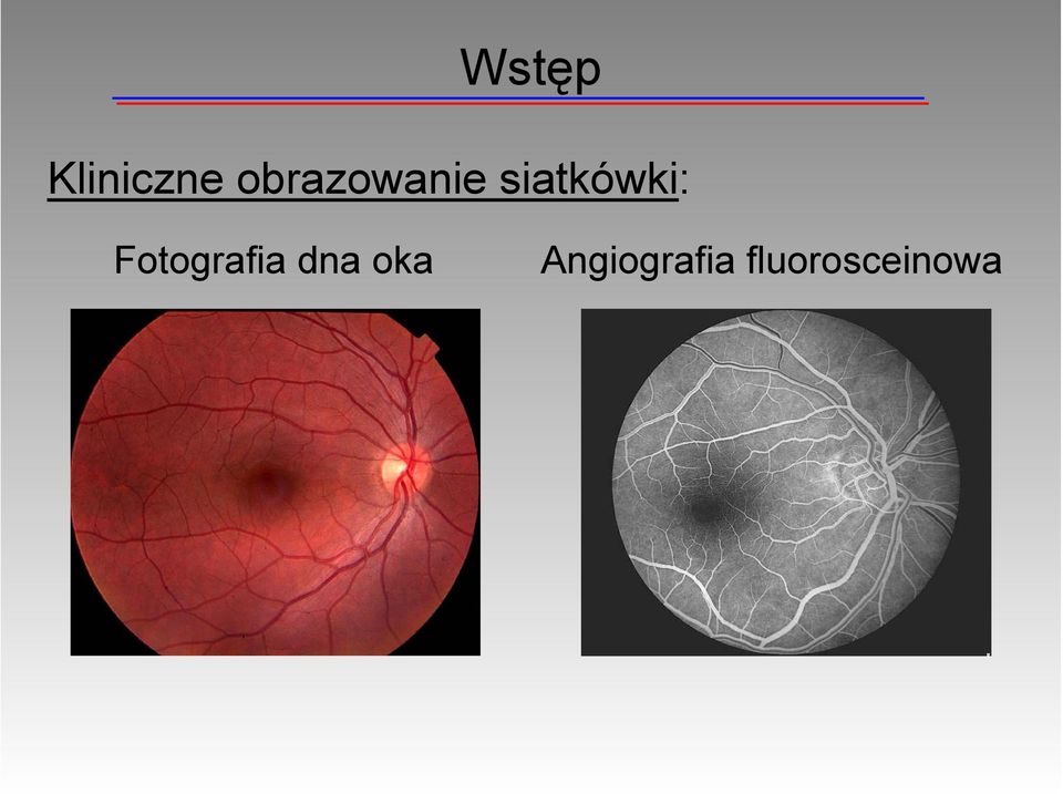 siatkówki: